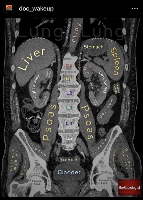 Desk Pinboard, Radiology Positioning, Sonography Notes, Radiography Student, Diagnostic Medical Sonography Student, Punkty Spustowe, Medical Radiography, Sonography Student, Medical Sonography