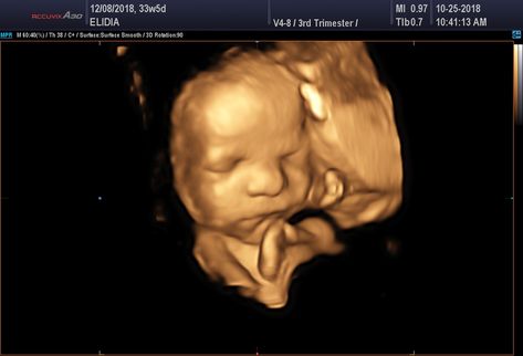 ultasound baby pictures in video.  Located in Sandy Utah, Fetal Studio can give you some amazing looks at your unborn baby.  4d images are much better than 3d.  Come see for yourslelf. 4d Ultrasound Pictures, Sandy Utah, 4d Ultrasound, Sound Picture, Ultrasound Pictures, Unborn Baby, Place To Visit, Ultrasound, Baby Pictures