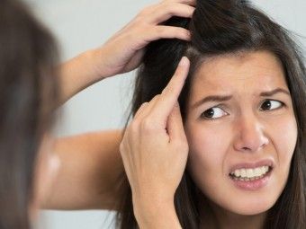 How To Remove Hair Color With Baking Soda? Dandruff Causes, Home Remedies For Dandruff, Dandruff Remedy, Getting Rid Of Dandruff, Hair Transplant Surgery, Best Hair Transplant, Hair Dandruff, Hair Problems, Hair Restoration