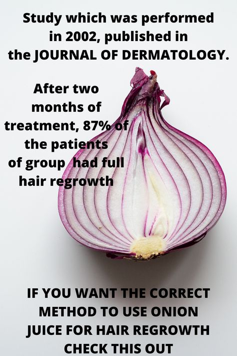 Hair Regrowth Oils, Onion Hair Growth, Onion Juice For Hair, Onion For Hair, Onion Juice, Prevent Hair Fall, Regrow Hair, For Hair Growth, Hair Remedies