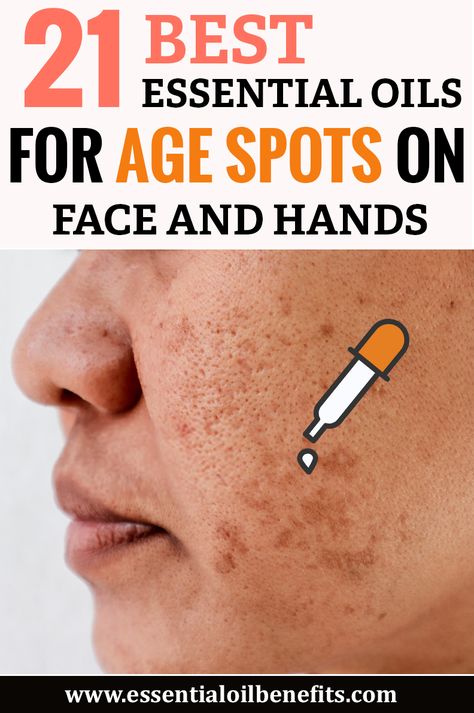 Age Spots Essential Oils, Essential Oils For Age Spots, Brown Spots On Hands, Age Spots On Face, Brown Age Spots, Brown Spots On Skin, Makeup Tip, Brown Spots Removal, Beach Blonde