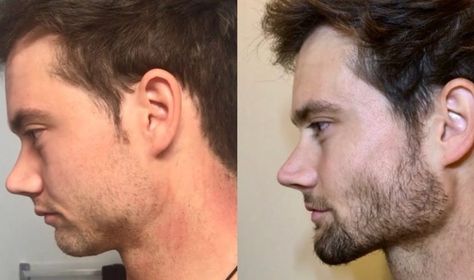 This Magic Tongue Posture Will Make Your Face More Attractive | by Peter White | Jul, 2022 | Medium Jaw Exercises, Jawline Exercise, Face Transformation, Chiseled Jawline, Connor Murphy, Double Menton, Before After Photo, Facial Exercises, Jaw Bone