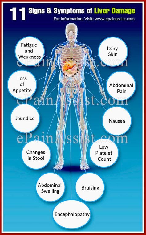 10 Warning Signs of Liver Damage You Should Not Ignoreu Signs Of Liver Damage, Quadrants Of The Abdomen, Liver Damage, Liver Detoxification, Healing Waters, Body Organs, The Liver, Loose Skin, Abdominal Pain