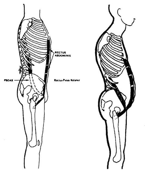 Psoas Major, Rectus Abdominis Muscle, Rectus Abdominis, Psoas Release, Hip Problems, Pot Belly, Tight Hip Flexors, Spine Health, Psoas Muscle