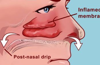 How to clear your sinuses with nothing but your fingers (video below) Remedy For Sinus Congestion, Clear Your Sinuses, Blocked Sinuses, Sinus Drainage, Sinus Remedies, Home Remedies For Sinus, Lymph Drainage Massage, How To Clear Sinuses, Stuffy Nose Remedy