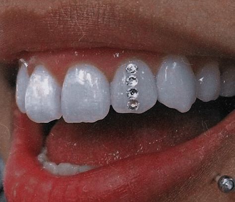 Teeth Gems Ideas, Tooth Gem Ideas, Tooth Gems Aesthetic, Tooth Gems Ideas, Teeth Gems, Pretty Teeth, Dental Jewelry, Grillz Teeth, Diamond Teeth