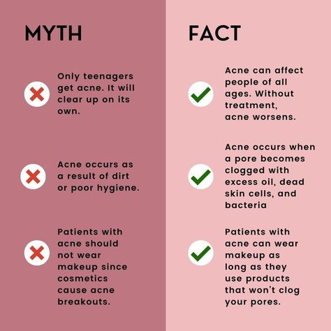 Ideal Skin Care Routine, Skin Care Myths, Daily Fun Facts, Clear Skin Fast, Skincare Facts, Skin Facts, Esthetician Marketing, Skin Care Business, Skin Advice