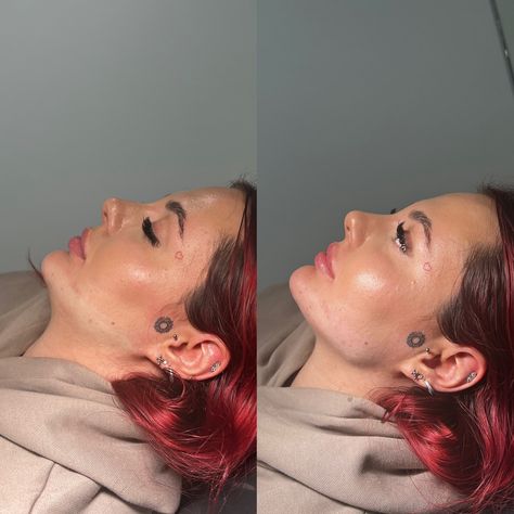 Sculpt Your Profile with Jaw Filler at Faces By Bae 📐 Fillers Before And After, Facial Balancing Filler, Jaw Filler, Face Fillers, Facial Aesthetics, Lip Fillers, Your Profile, Round Face, Plastic Surgery