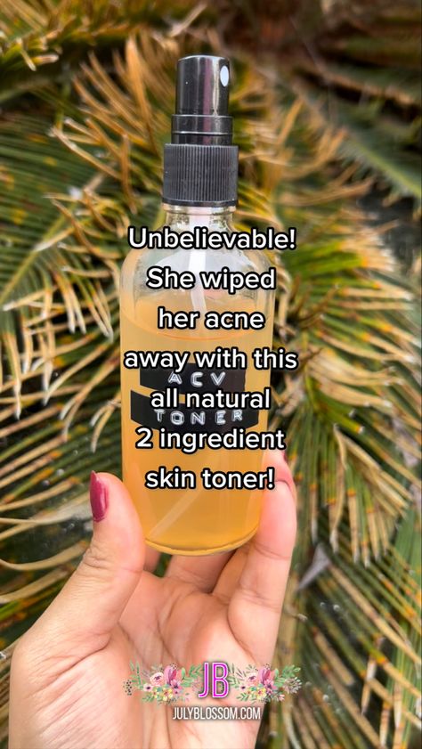 Apple Cider Face Toner, Apple Cider Vinegar Toner Recipe, Apple Cider Vinegar For Skin Care, How To Use Apple Cider Vinegar For Skin, Diy Face Toner For Acne, Apple Cider Vinegar Skin Care, Apple Cider Vinegar Face Wash Recipe, Acv Toner Diy, Apple Cider Vinegar Rinse For Hair