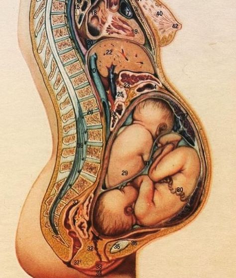 Pregnancy Anatomy, Twin Belly, Twin Pregnancy Belly, Twin Mum, 4th Trimester, Pregnancy Art, Childbirth Education, Postpartum Body, Pregnant Mother