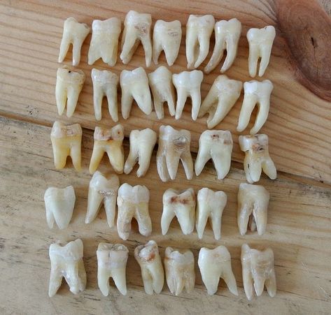 Loose Tooth, Human Teeth, Dental Art, Natural Teeth Whitening, Budget Planer, Tooth Fairy, Teeth Whitening, Bones, Polymer Clay