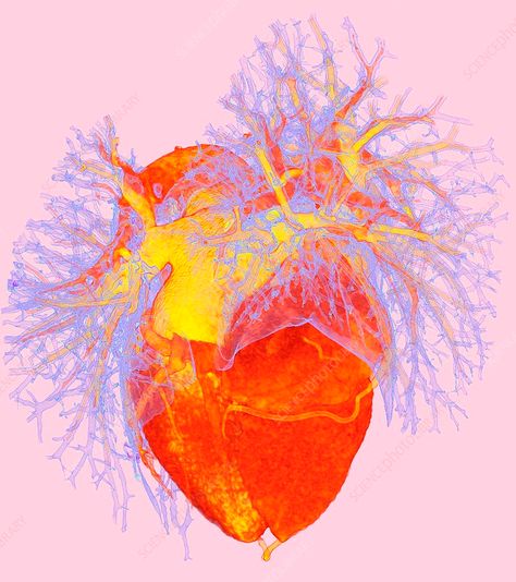 Heart With Veins, Heart Scan, Heart Vessels, Flatware Crafts, Heart Organ, Golden Record, Computed Tomography, Heart 3d, Arteries And Veins