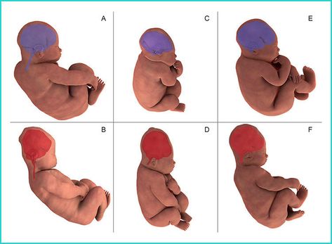 Baby Head Shape, Brain Shape, Brain Size, Emergency C Section, Stages Of Labor, Mri Scan, Physical Change, 3d Images, Body Systems