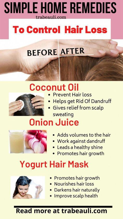 Best 5 Natural Home Remedies To Stop Hair Loss and falls. It's a really effective and easy recipe. #hairloss #homeremedies #trabeauli #hairfall #haircare #NaturalRemediesToPreventHairLoss #FemaleHairLossSolutions Darken Hair Naturally, Yogurt Hair Mask, How To Darken Hair, Haircuts For Round Faces, Easy Care Hairstyles, Getting Rid Of Dandruff, Hair Mistakes, Healthy Hair Tips, Hair Control