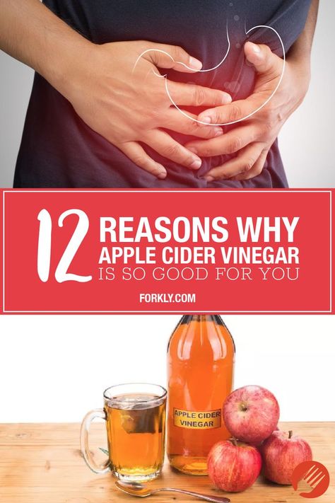 Apple Cider Vinegar Remedies, Cider Vinegar Benefits, Apple Cider Vinegar Benefits, Apple Cider Vinegar Drink, Cold Sores Remedies, Natural Cold Remedies, Cold Home Remedies, Natural Cough Remedies, Cold Remedies