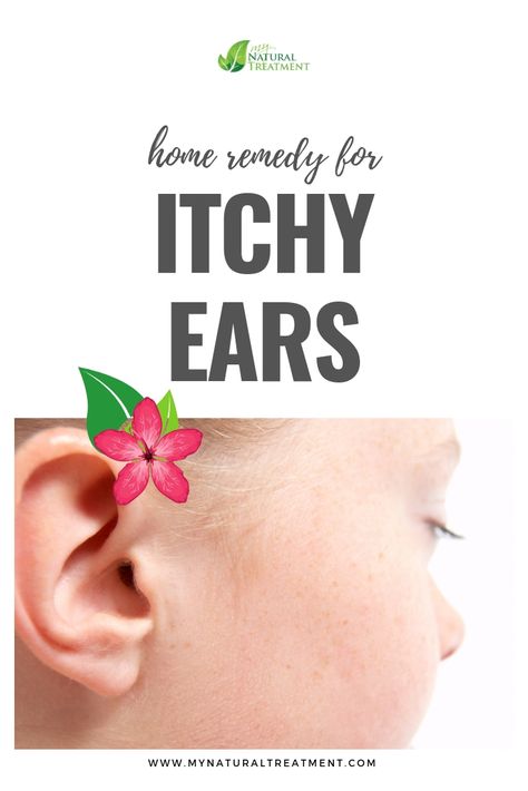 Home Remedy for Itchy Ears with Garlic and Lemon #earitch #itchyears #itchingears #earitching #itchyearsremedy #itchyearcure #homeremedy #earremedy #earitchremedy Itchy Ears Remedies, Ear Problems, Survival Preparedness, Itchy Ears, Ear Ache, Outer Ear, It Goes Like This, Ear Drops, Amazing Home