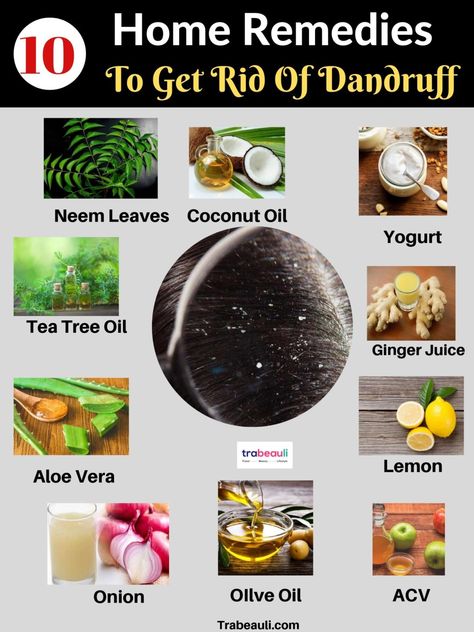 Get Rid Of Dandruff Fast, How To Treat Dandruff, Home Remedies For Dandruff, Rid Of Dandruff, Fresh Aloe Vera Gel, Dandruff Remedy, Bridesmaid Photoshoot, Getting Rid Of Dandruff, Fresh Aloe Vera