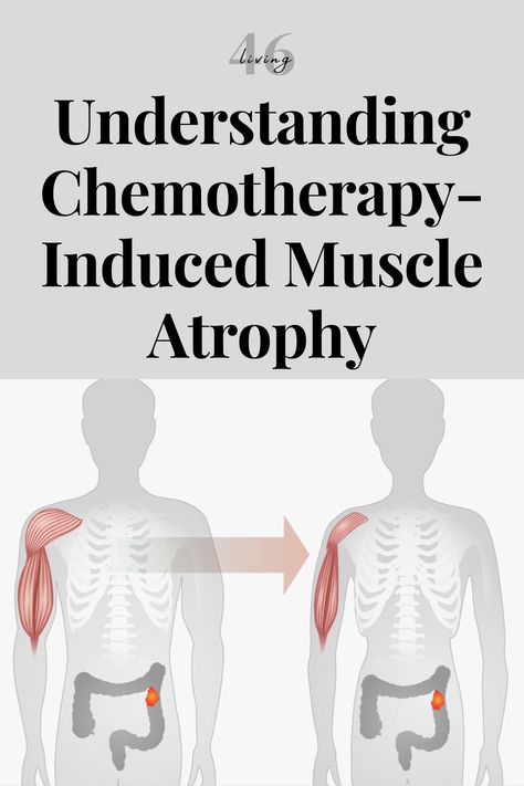 Discover how to reverse chemotherapy-induced muscle atrophy! Explore diet tips, exercise routines, and recovery strategies. #CancerRecovery #MuscleAtrophy #Chemotherapy #HealthyLiving Chemo Recovery Tips, Exercise During Chemo, Atrophy Muscle, Chemo Care, Oncology Nurse, Muscle Atrophy, Oncology Nursing, Exercise Routines, Healthy Advice