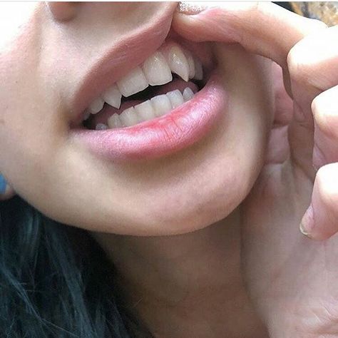 casual fangs Canine Teeth Human Aesthetic, Sharp Canine Teeth Human, Vampire Fang Aesthetic, Teeth Aesthetic, Fake Injury, Canine Tooth, Perfect Teeth, Vampire Fangs, Vampire Teeth