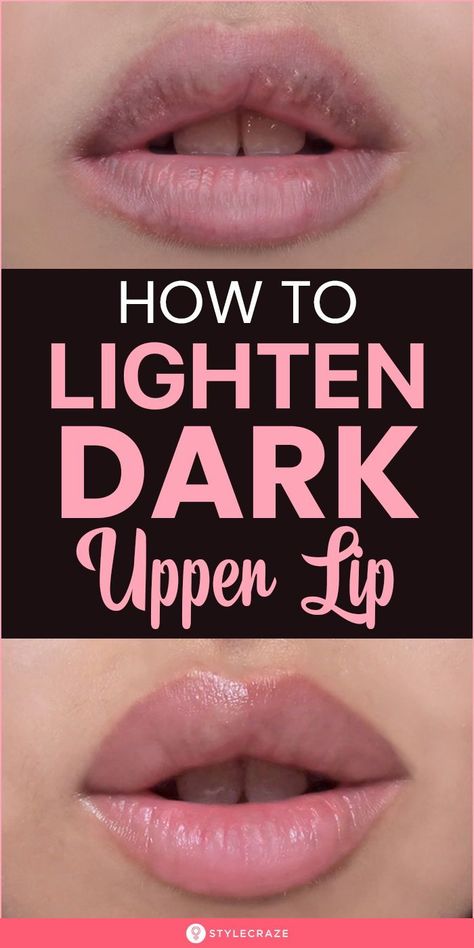 Dark Upper Lip, Lighten Dark Lips, Lip Lightening, Reduce Hair Growth, Lip Care Tips, Recipes To Try At Home, Upper Lip Hair, Beauty Hacks Lips, Lip Care Routine