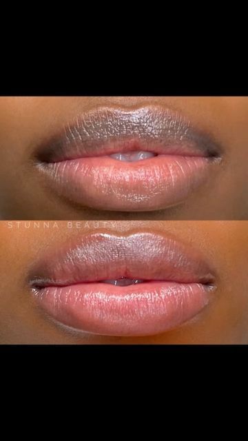 Lip Blushing On Dark Skin, Lip Blush On Dark Lips, Lip Blush Black Women, Lip Blushing Tattoo Before And After Black Women, Dark Lip Neutralization, Dark Skin Lips, Lip Blushing Tattoo Colors Dark Skin, Lip Blushing Tattoo Before And After Natural, Lip Neutralization Before And After