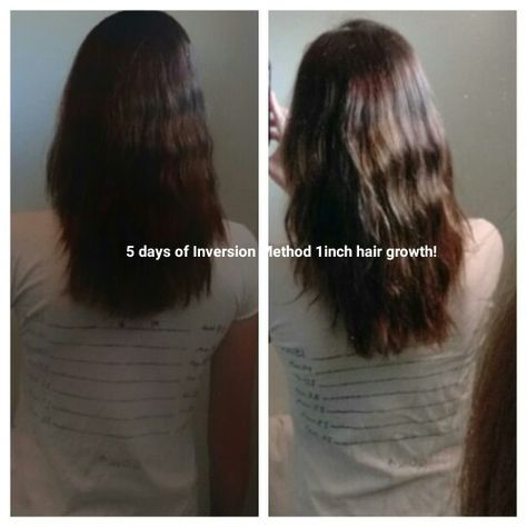 I gave the inversion method ago! Only tried it 5 days and am shocked it actually showed results! Give it ago x Inversion Hair Growth Method, Inversion Method For Hair Growth, Hair Mask For Hair Fall, Mask For Hair Fall, Honey For Hair, Inversion Method, Hair Growth Methods, Banana Hair Mask, Acne Oil