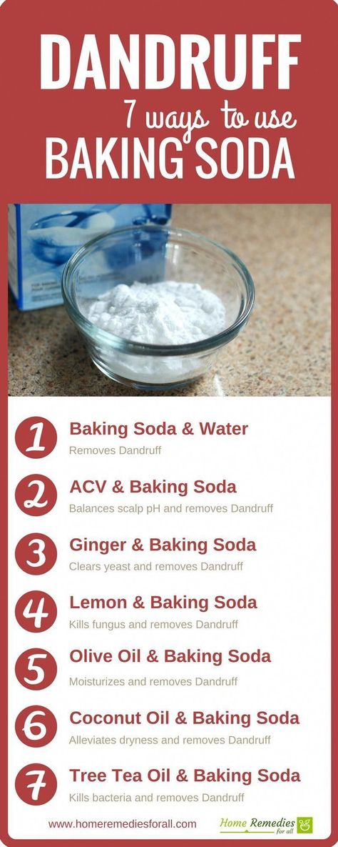 #BakingSodaShampooMixture Remove Dandruff Home Remedies, Baking Powder For Cleaning, Benefits Of Baking Soda, Natural Odor Remover, Baking Soda For Dandruff, Baking Soda Health, Home Remedies For Dandruff, Baking Soda Shampoo Recipe, Baking With Coconut Oil