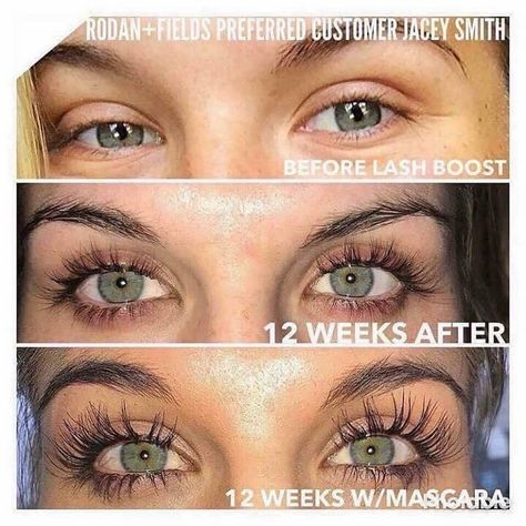 Eyelash Growth Serum Diy, Eyelash Growth Vaseline, Best Eyelash Serum, Eyelash Growth Cycle, Oil For Eyelash Growth, Rodan And Fields Lash Boost, Eyelash Growth Diy, Eyelash Serums, Eye Lashes Drawing