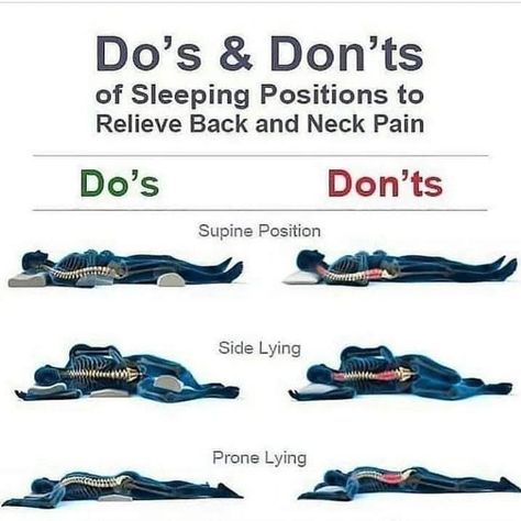 The Do's and Don't of sleeping positions to relieve back and neck pain . . . . #healthylifestyle #healthyliving #healthylife #healthychoices #healthyhabits #healthybody #healthychoice #healthychoicesmatter Sleep Posture, Sciatica Pain Relief, Lower Back Pain Exercises, Ways To Sleep, Lower Back Pain Relief, Sleep Health, Do's And Don'ts, Back Pain Exercises, Body Pain