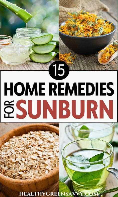 Home Remedy For Sunburn, How To Help Sunburn, Remedies For Sunburn, Herbal First Aid, Home Remedies For Sunburn, Heal Sunburn, Herbs For Sleep, Natural Remedies For Sunburn, Sunburn Remedies