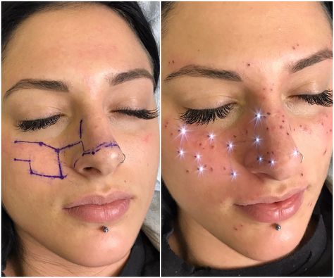 Dots On Face, Piercing No Rosto, Makeup Artist Tattoo, Facial Markings, Shape Tattoo, Zodiac Sign Tattoos, Constellation Tattoos, Cosmetic Tattoo, Face Tattoos