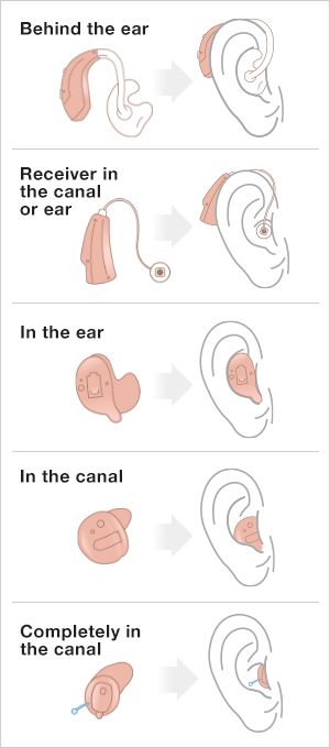 Hearing Aid Reference, Hearing Aid Drawing Reference, Ear Defenders Aesthetic, Hearing Aids Aesthetic, Deaf Tattoo, Slp Outfits, Fluency Assessment, Modern Oc, Hearing Aids Accessories