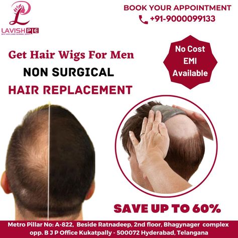 Hair Replacement For Men, Hair Wigs For Men, Wigs For Men, Regrow Hair, Bald Heads, Hair Solutions, Hair Replacement, Hair Wigs, Wig Hairstyles