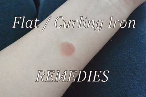 10 Remedies for Flat Iron and Curling Iron Burns!  Great list! I didn't know half of these! Pin now and read later! This is the ONLY pin on Pinterest! Curling Iron Burn, Curling My Hair, Curling Flat Iron, Iron Burn, Burn Remedy, Curly Iron, Burn Relief, Treat Burns, Diy Essential Oil Recipes