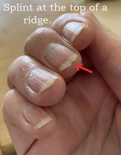 Vertical Ridges On Fingernails, Fingernail Ridges, Nail Ridges, Split Nails, Grow Nails Faster, Hiding Ugly, Nail Problems, Nail Growth, Nail Strengthener