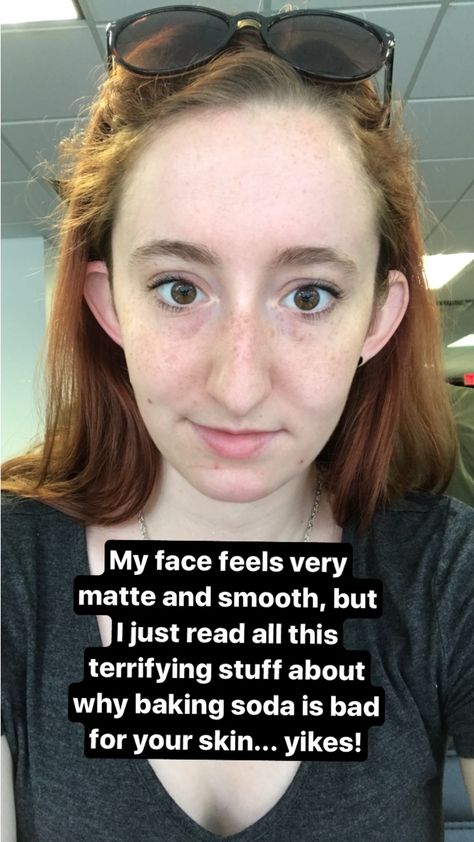 LittleThings.com : Baking Soda Face Wash Controversy : I Smeared Baking Soda On My Face Every Night For A Week. Here's How My Skin Looked 7 Days Later -- However, I eventually read about the potential negative effects. It wasn't until after I'd been using baking soda on my face for a few days that I found out how baking soda could negatively impact my skin. I read multiple studies from Dermatology, the International Journal of Cosmetic Science, and Acta Dermato-venereologica about the ways in... Baking Soda Face Wash, Baking Soda Dry Shampoo, Low Thyroid Remedies, Diy Shampoo Recipe, Ingrown Hair Remedies, Baking Soda For Hair, Baking Soda Face, Baking Soda Benefits, Bad Acne