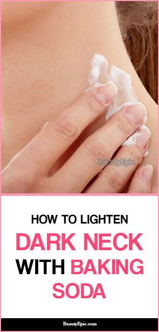 How to Get Rid of Dark Neck with Baking Soda Dark Neck Remedies, Face Remedies, Dark Neck, School Beauty, Dark Armpits, Diy Dry Shampoo, Relationship Comics, Shampoo Recipe, Dark Underarms