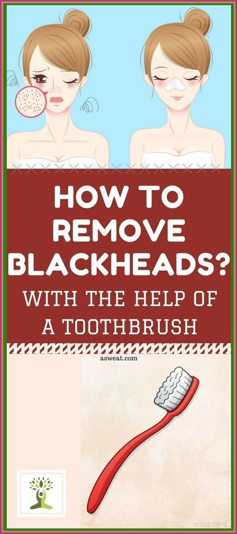 How to Remove Blackheads with the Help of a Toothbrush How To Remove Blackheads, Cleaning Your Colon, To Remove Blackheads, Health Signs, Remove Blackheads, School Communication, Skin Condition, Health Planner, Creating A Newsletter