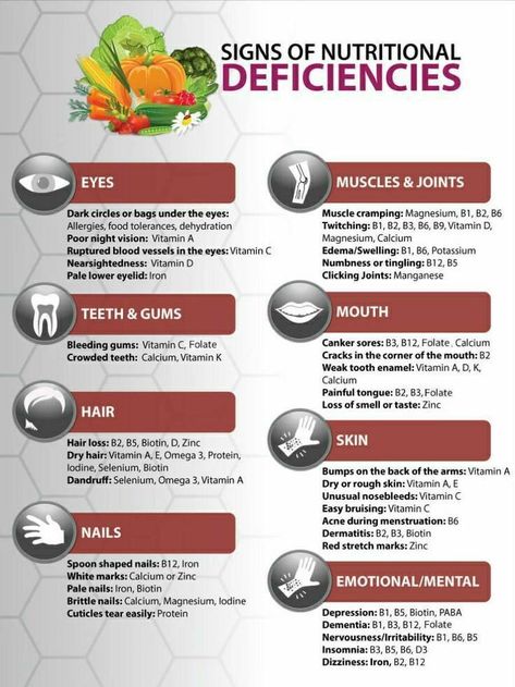 Food Health Benefits, Magnesium Deficiency, Dr Sebi, Nutritional Deficiencies, Home Health Remedies, Health Vitamins, Health And Fitness Articles, Herbs For Health, Health Knowledge