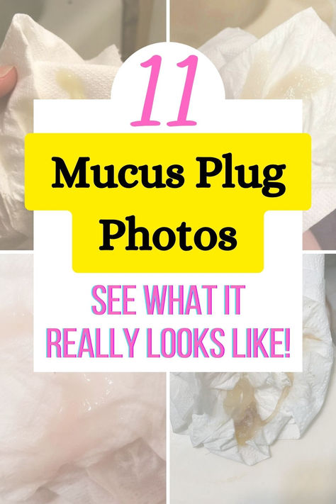 Many first time parents wonder what a mucus plug really looks like during pregnancy and right before labor. If you're a new mom and curious, here are 11 photos of mucus plugs that show different colors, sizes, and shapes. Learn the difference between what a mucus plug and bloody show looks like and how much mucus plug is normal before going into labor and during labor. Click through for all the details and photos! Mucus Plug Signs Labor, Third Trimester Photos, Belly Mapping Pregnancy, Ways To Go Into Labor Faster, Mucus Plug Look Like, Miles Circuit Labor, 1st Month Of Pregnancy, Mucus Color, Cervix Dilation