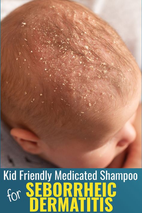 Many people see the picture of this infant and think dandruff, but this is actually called seborrheic dermatitis.  Dr. Eddie’s Happy Cappy shampoo and body wash is a kid friendly medicated shampoo and body wash for relief of skin and scalp itching, irritation, redness, flaking, and scaling associated with seborrheic dermatitis. #SeborrheicDermatitis Happy Cappy, Cradle Cap, Dandruff Shampoo, Beard Growth, Dry Scalp, Acid Reflux, Sulfate Free, Beard Oil, Dandruff