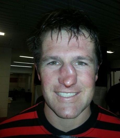 Broken Nose Nose Picture, South African Rugby, Broken Nose, English Club, Christmas Dog Outfits, Media Makeup, Parents Be Like, Special Fx Makeup, Rugby Player