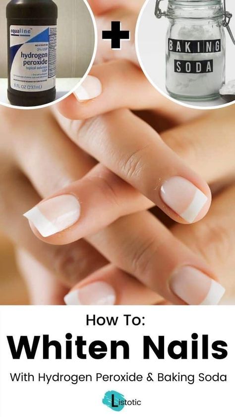 Learn how to whiten your nails with just hydrogen peroxide and baking soda! If you have stubborn stains on your nails that refuse to go away, then this simple life hack may be what you're looking for. Click on the pin for the full instructions and more nail whitening methods over on Listotic! #lifehack #manicure How To Whiten Nails, Baking Soda Nails, Make Nails White, Stained Nails, Nail Whitening, Nail Polish Stain, Baking Soda Uses, Baking Soda Shampoo, Nail Fungus