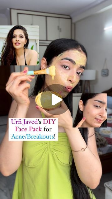 Besan Face Mask Glowing Skin, Curd Face Mask, Diy Face Mask For Acne, Face Mask For Acne, Urfi Javed, Mask For Acne, Lemon Face Mask, Honey Face Mask, Body Acne