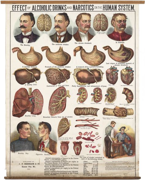 A spectacular 1910 chromolithographic poster illustrating the effects of alcohol and tobacco, issued just as the Temperance movement was nearing its apogee. Temperance Movement, Effects Of Alcohol, Antique Maps, Dark Ages, Vintage Love, Vintage Advertisements, American History, Metal Posters Design, Metal Posters