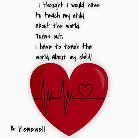 Brady -HLHS Half a heart not half a life Chd Valentines, Hlhs Quotes, Chd Awareness Quotes, Chd Quotes, Organ Donor Quotes, Chd Mom, Chd Babies, Chd Warrior, Chd Heart