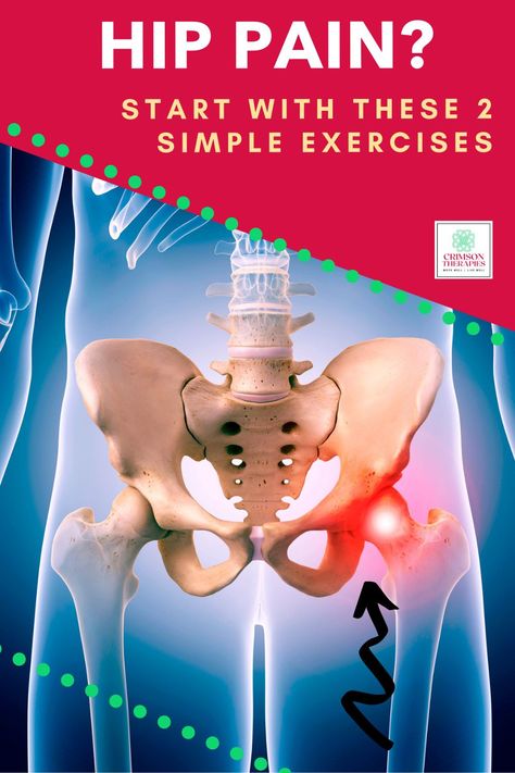 Sore Hips Remedies, Isometric Hip Exercises, Hip Stabilization Exercises, Exercises For Hip Pain, Stretches For Bursitis Hip Pain, Hip Pain Exercises, Yoga For Hip Pain, Hip Exercises For Arthritic Pain, How To Pop Your Hip Back Into Place