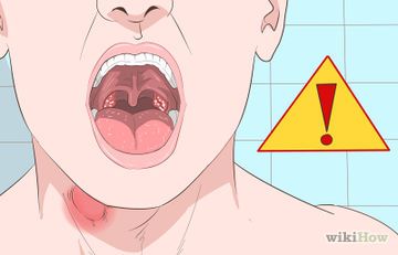 How to Get Rid of Sore Tonsils (with Pictures) - wikiHow Mucus In Throat, Heal Sore Throat, Honey For Sore Throat, Getting Rid Of Mucus, Mucus Relief, Getting Rid Of Phlegm, Scratchy Throat, Throat Remedies, Sore Throat Remedies