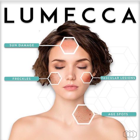 WellnessSpa @ Mcosmeticsurgery (@mcswellnesspa) • Instagram photos and videos Eyes Vision, Ipl Photofacial, Eye Vision, Intense Pulsed Light, Tanning Cream, Designer Frames, Vision Eye, The Glow Up, Bare Beauty