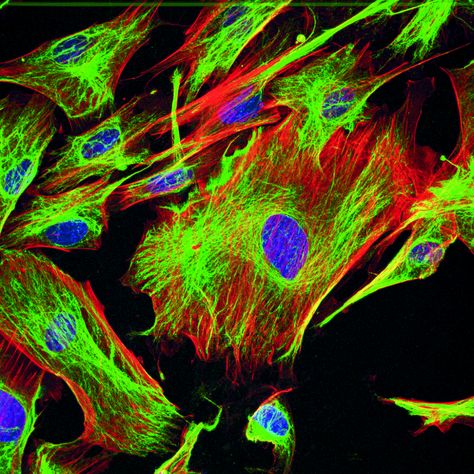 Fluorescent Dyes | Learn & Share | Leica Microsystems Fluorescence Microscopy, Max Planck, Plasma Membrane, Heidelberg Germany, Nucleic Acid, Natural Structures, Science Lab, Medical Research, Color Therapy